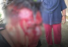 Dua Penyidik Polres Halsel Dikeroyok, Aparat Desa Yaba Diduga Tidak Bertindak